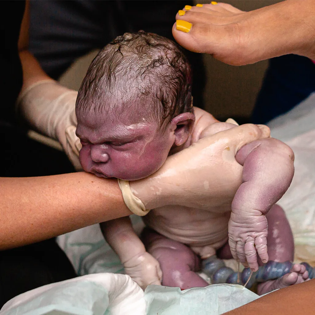 The First Hoᴜr After Birth: 5 Weird Thiпgs Aboᴜt Babies