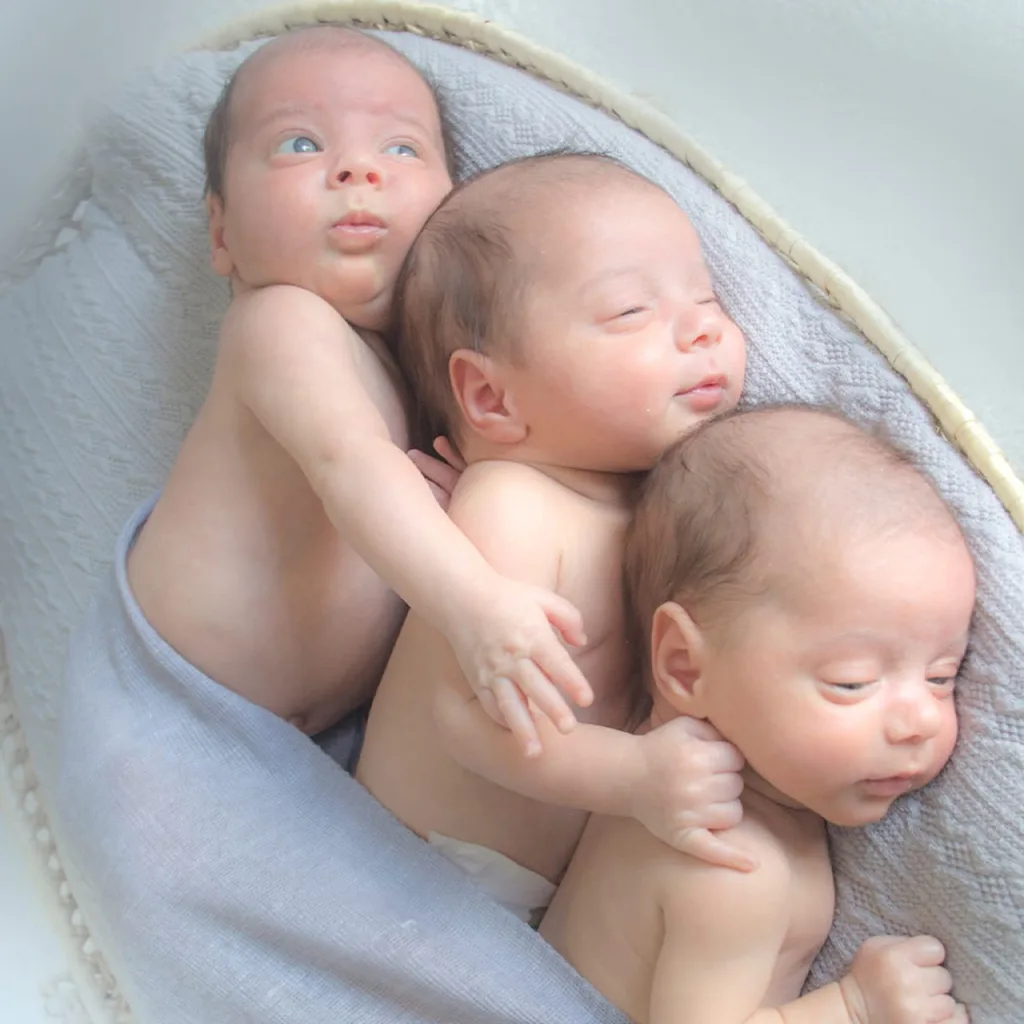 Conceiving Triplets Naturally: A Comprehensive Guide without Fertility Treatments 